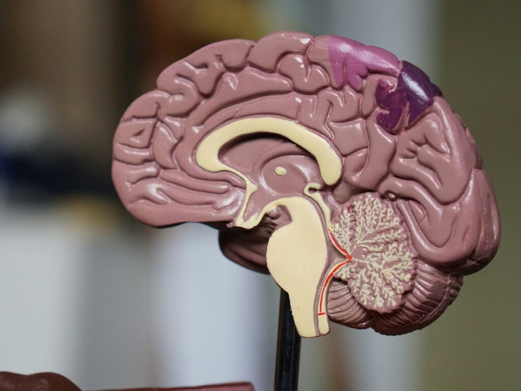 a brain model symbolizing alzheimer's disease